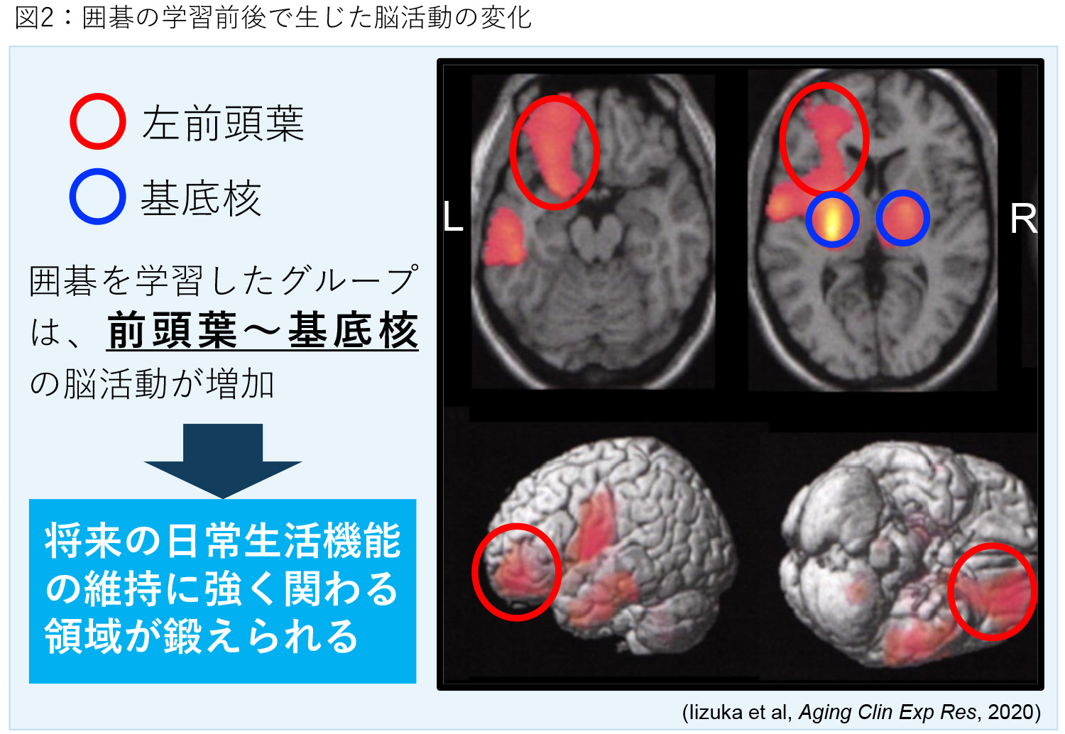 図2：囲碁の学習前後で生じた脳活動の変化